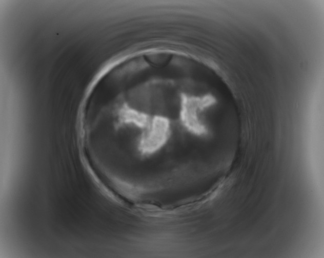 X0000085231522200703301714