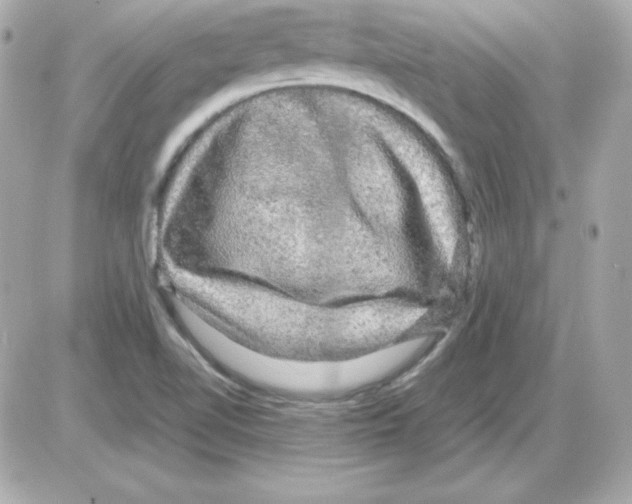 X0000085231510200704091944