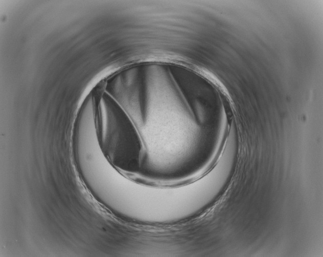 X0000085241138200703231617