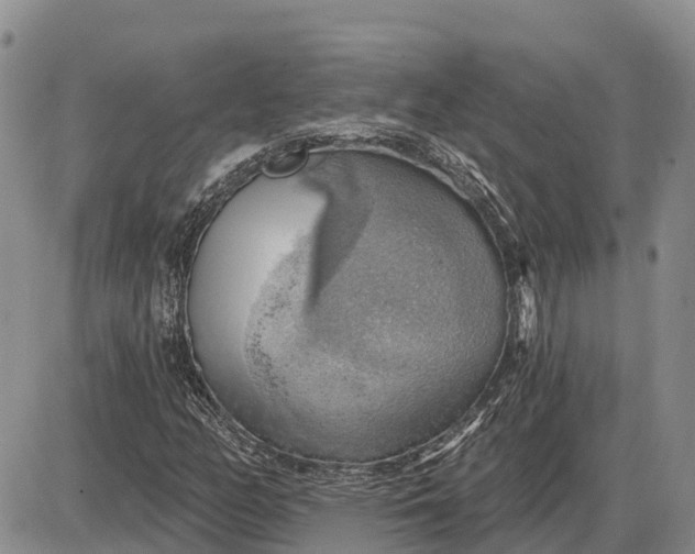 X0000085241158200703231617