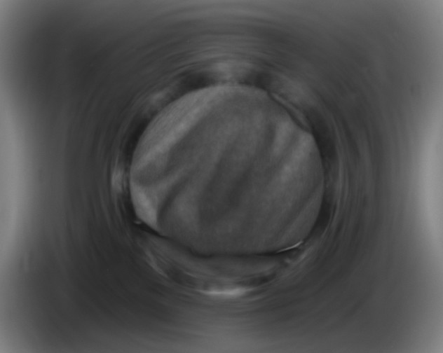 X0000085240137200703301756