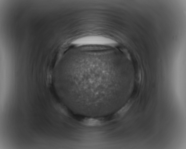 X0000085240180200703301755