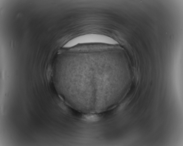 X0000085240189200703301755