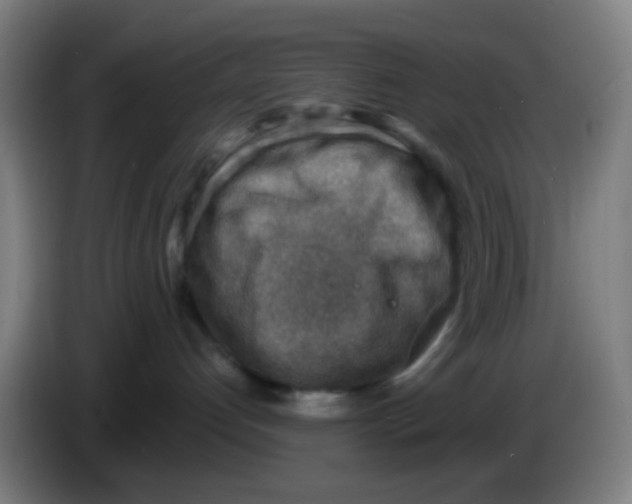 X0000085240192200703301755