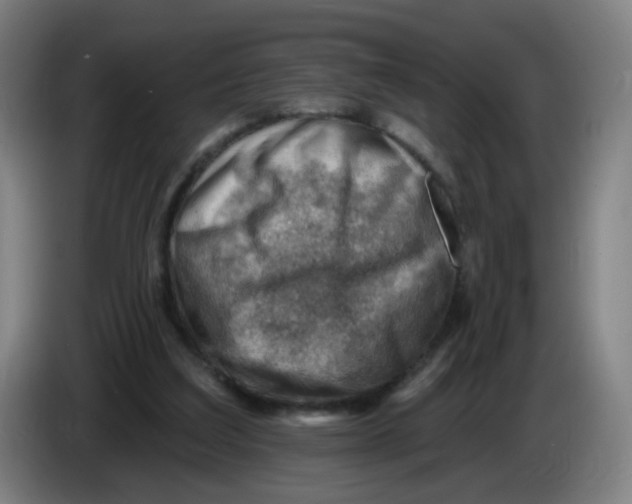 X0000085240203200703301755