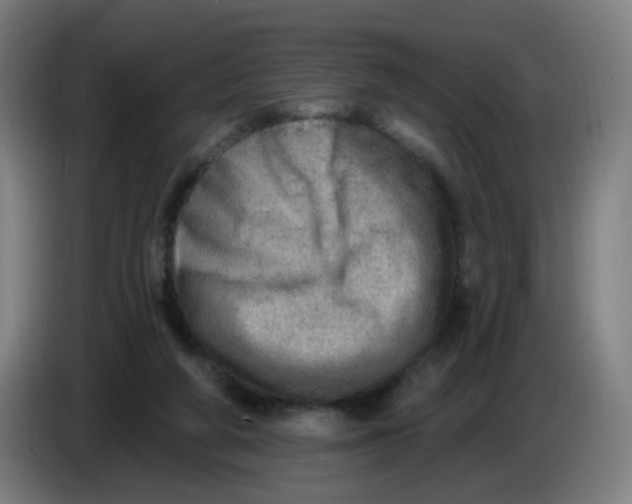 X0000085240210200703301755