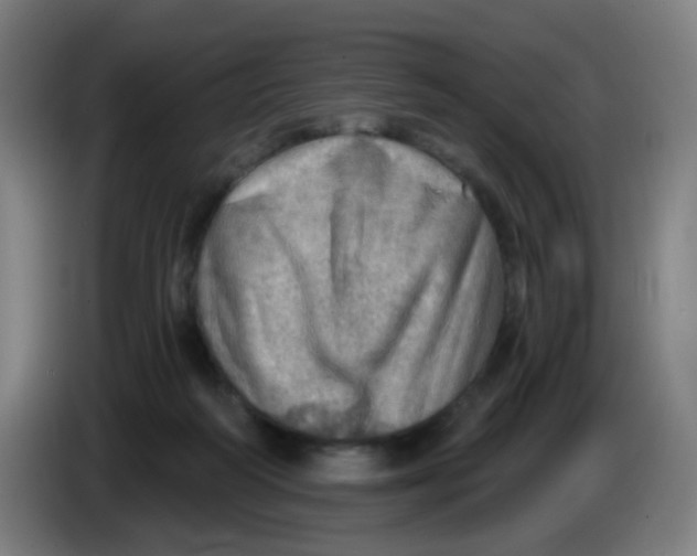 X0000085240218200703301754