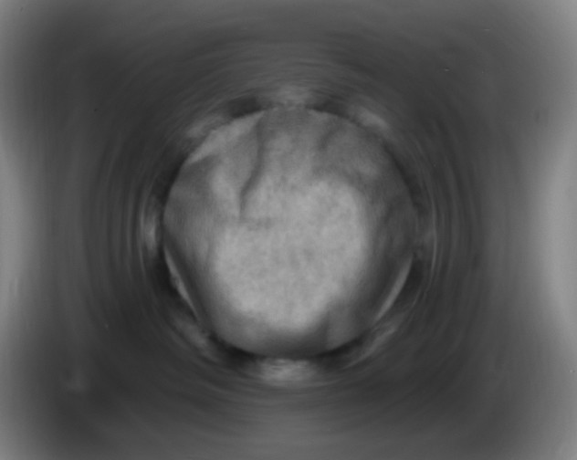 X0000085240334200703301753