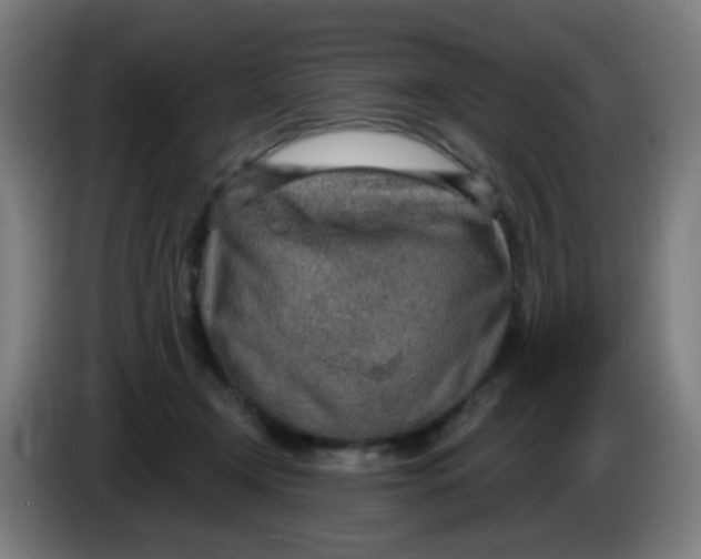 X0000085240366200703301753