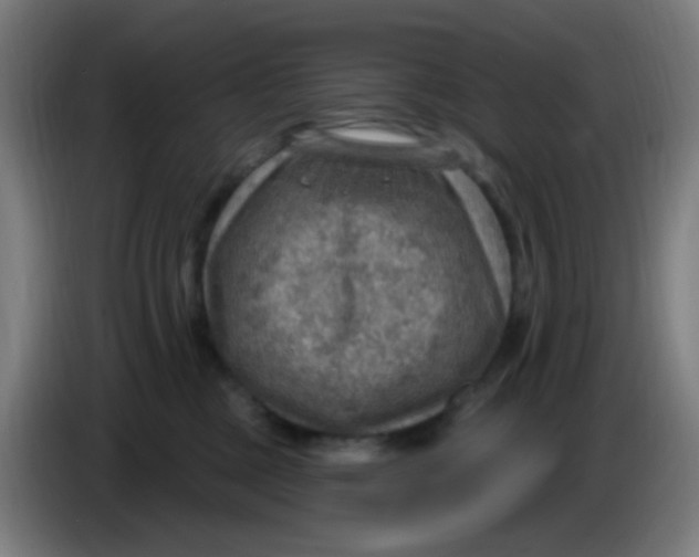 X0000085240377200703301753