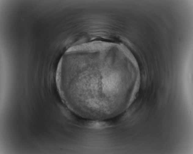 X0000085240379200703301753