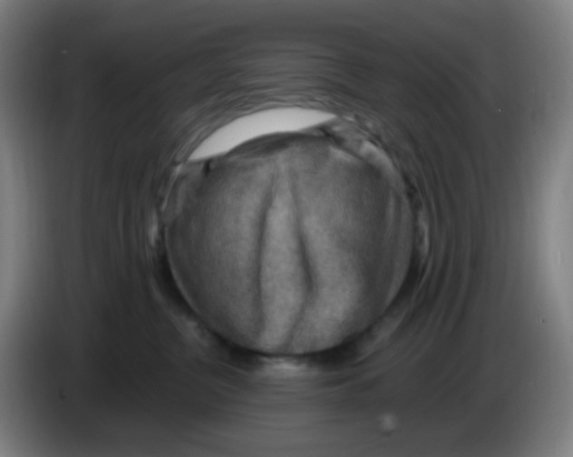 X0000085240380200703301753