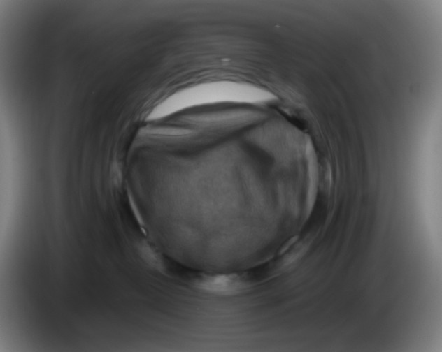 X0000085240382200703301753
