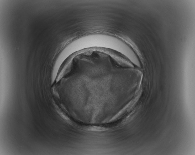 X0000085240393200703301752