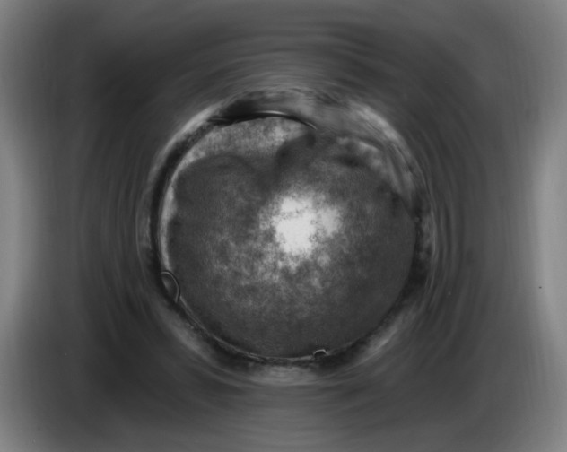 X0000085240399200703301752