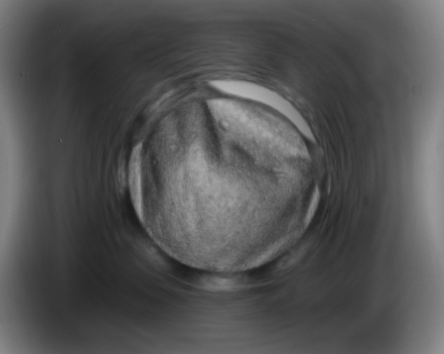 X0000085240479200703301751