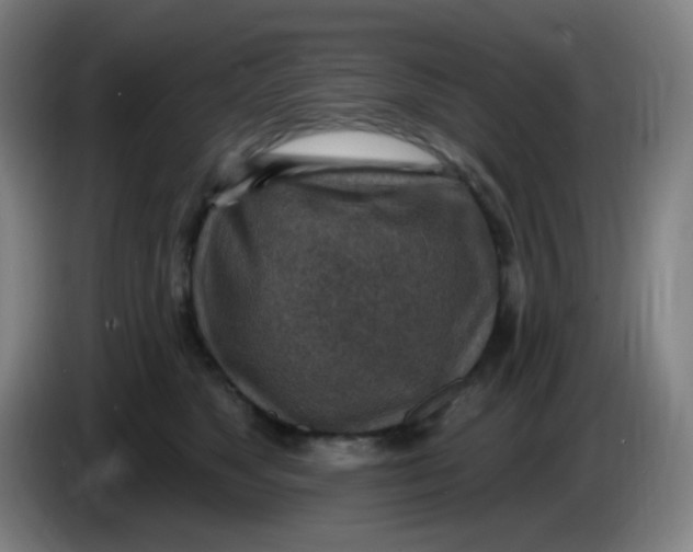 X0000085240517200703301750