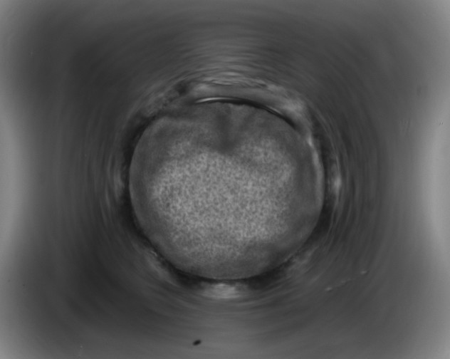 X0000085240566200703301750