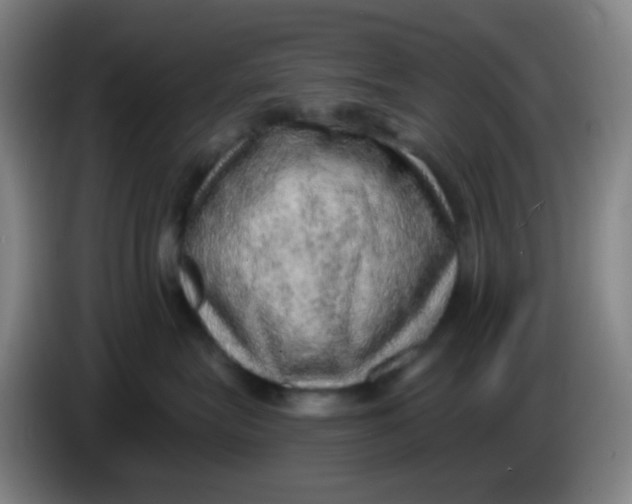 X0000085240575200703301750
