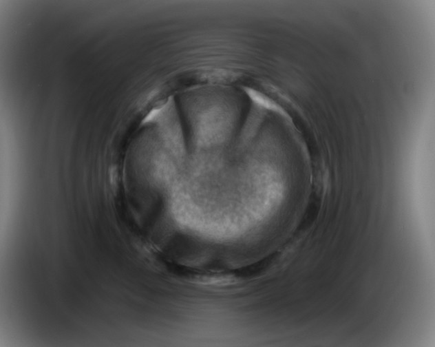 X0000085240716200703301747