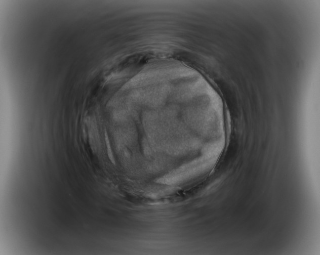 X0000085240818200703301745