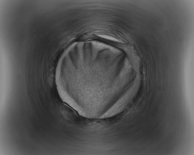 X0000085240868200703301745