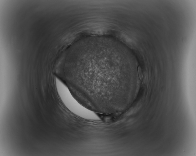 X0000085241202200703301740