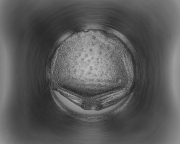 X0000085241241200703301740