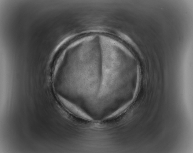 X0000085241360200703301738