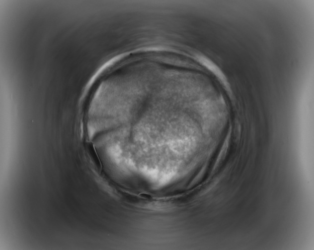 X0000085241368200703301738