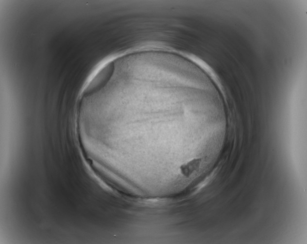 X0000085241390200703301738