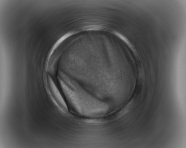 X0000085241418200703301737
