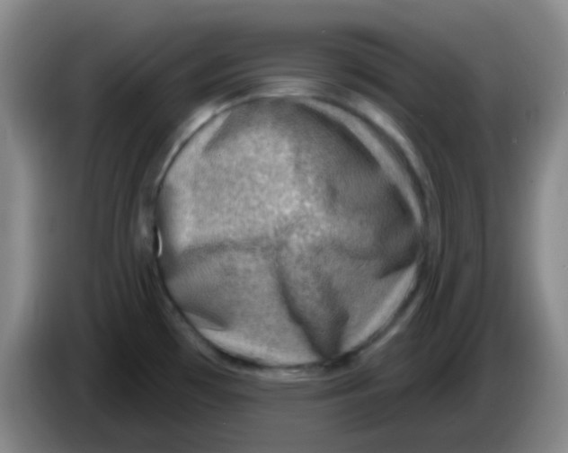 X0000085241481200703301737