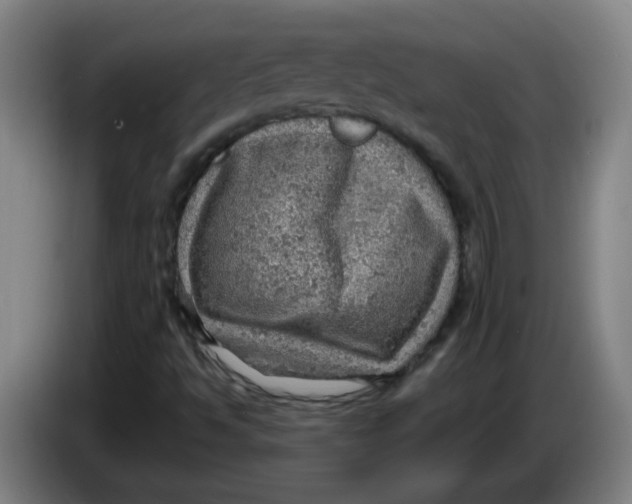 X0000085241494200703301736
