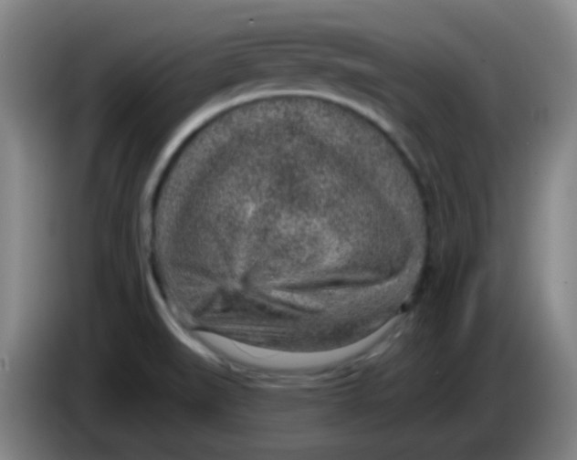 X0000085241519200703301736