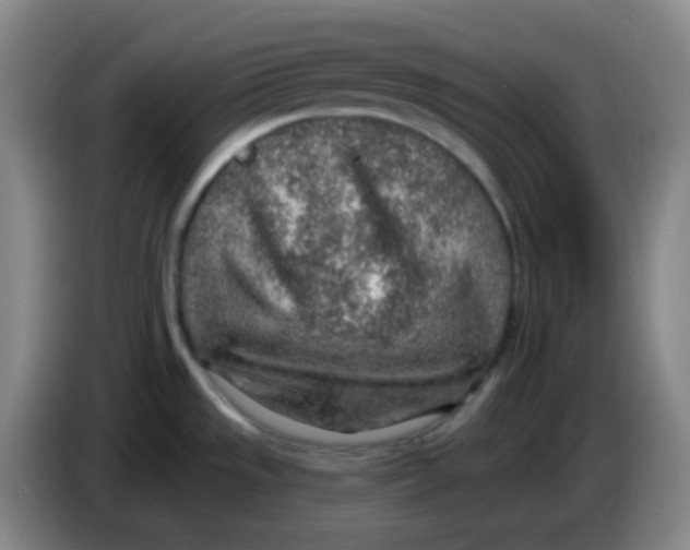 X0000085241533200703301736