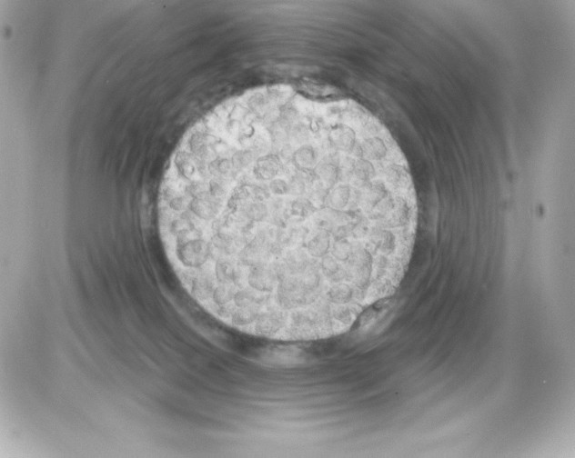 X0000085240086200704092034