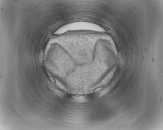 X0000085240189200704092033