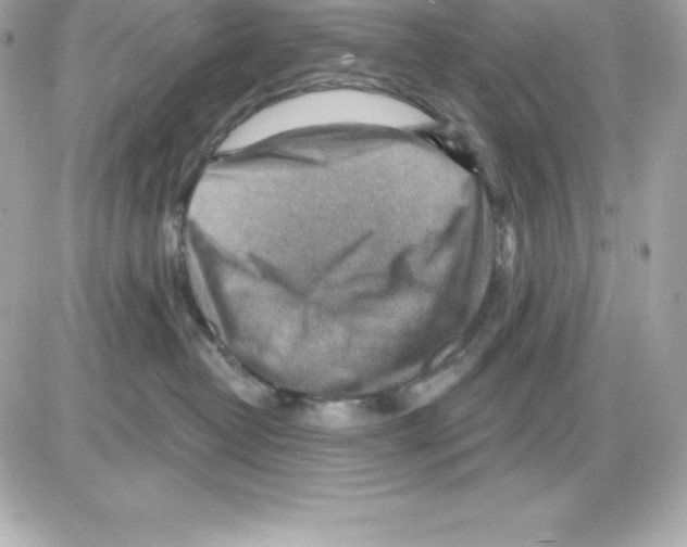 X0000085240382200704092029