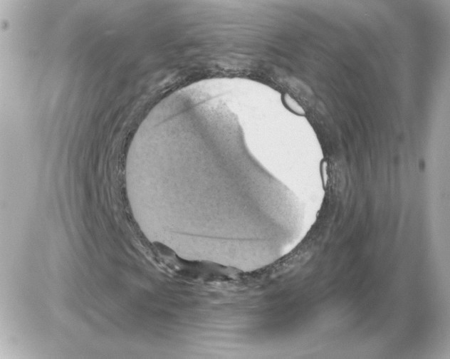 X0000085241009200704092017