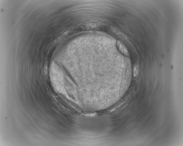 X0000085241011200704092017