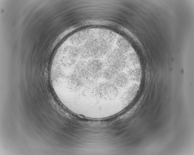 X0000085241025200704092018