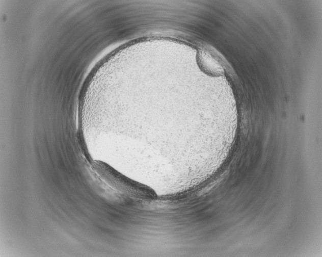 X0000085241036200704092018