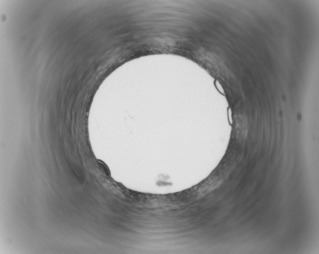 X0000085241057200704092017