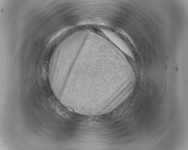 X0000085241064200704092017
