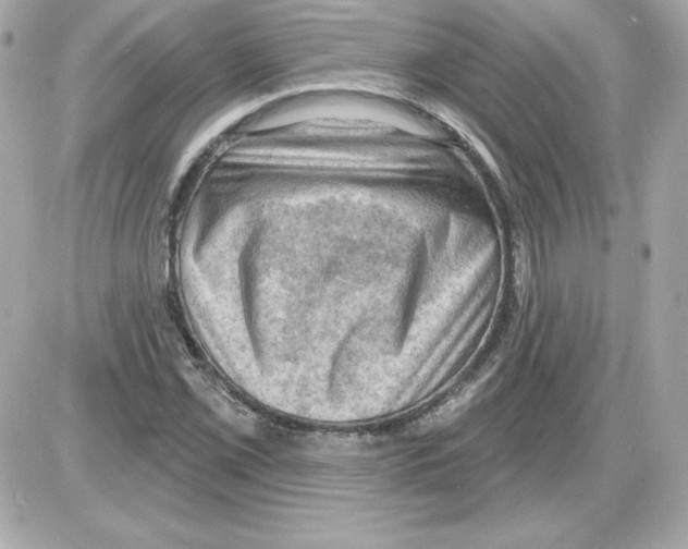 X0000085241069200704092017