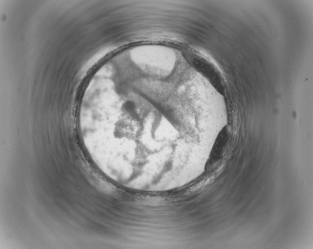 X0000085241071200704092017