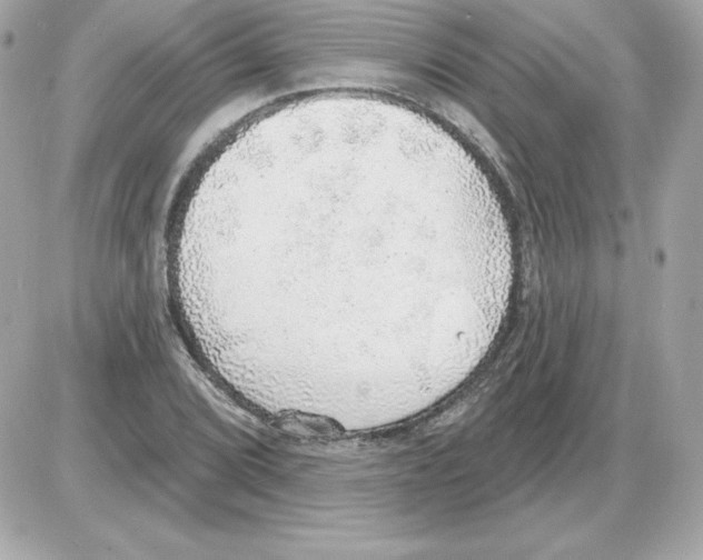X0000085241072200704092017