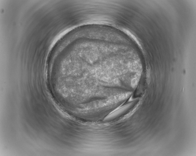 X0000085241077200704092017