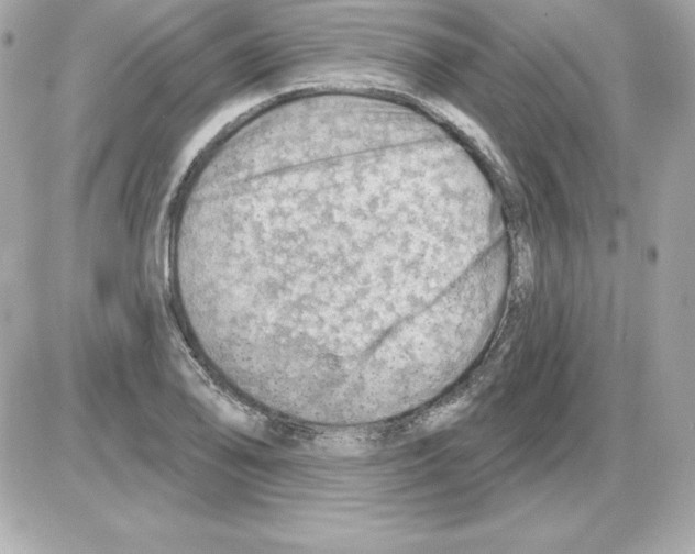 X0000085241078200704092017